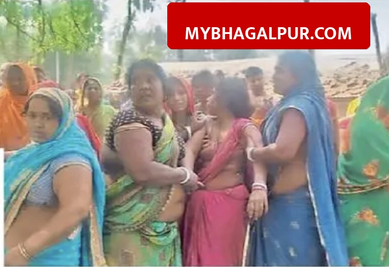 भागलपुर के बिहपुर में अमरूद के पेड़ से लटका मिला युवक का शव, मां ने कहा- मारकर टांग दिया