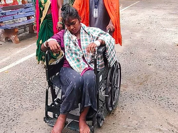 भागलपुर में बड़ा खतरा! रसेल वाइपर सांप ने छात्रा को काटा