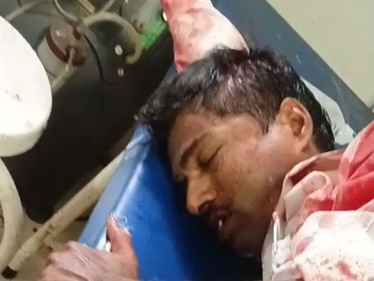 बिला स्टेशन पर ट्रेन चढ़ते समय युवक गंभीर रूप से घायल, गया रेफर