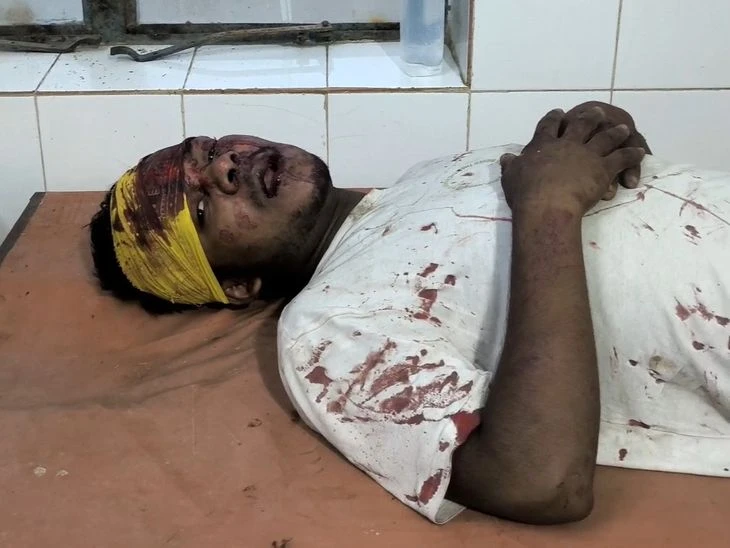कहलगांव में मोबाइल छीनने वाला हुआ हादसे का शिकार, रेलवे ट्रैक पर गिरकर हुआ गंभीर रूप से घायल